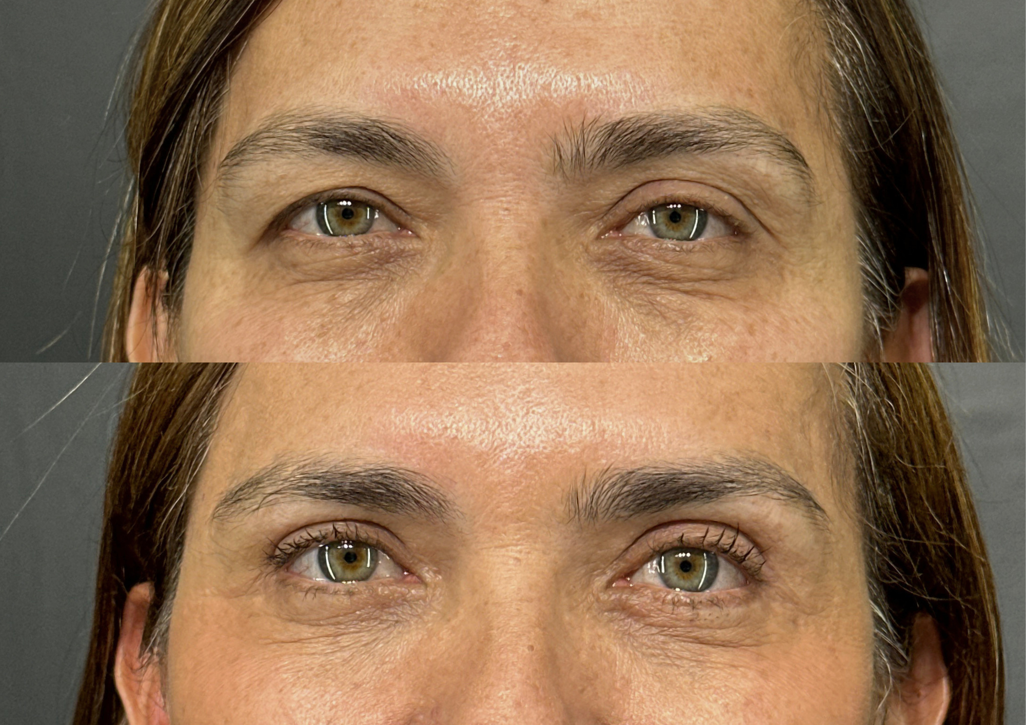 Antes e depois — Foto 1
