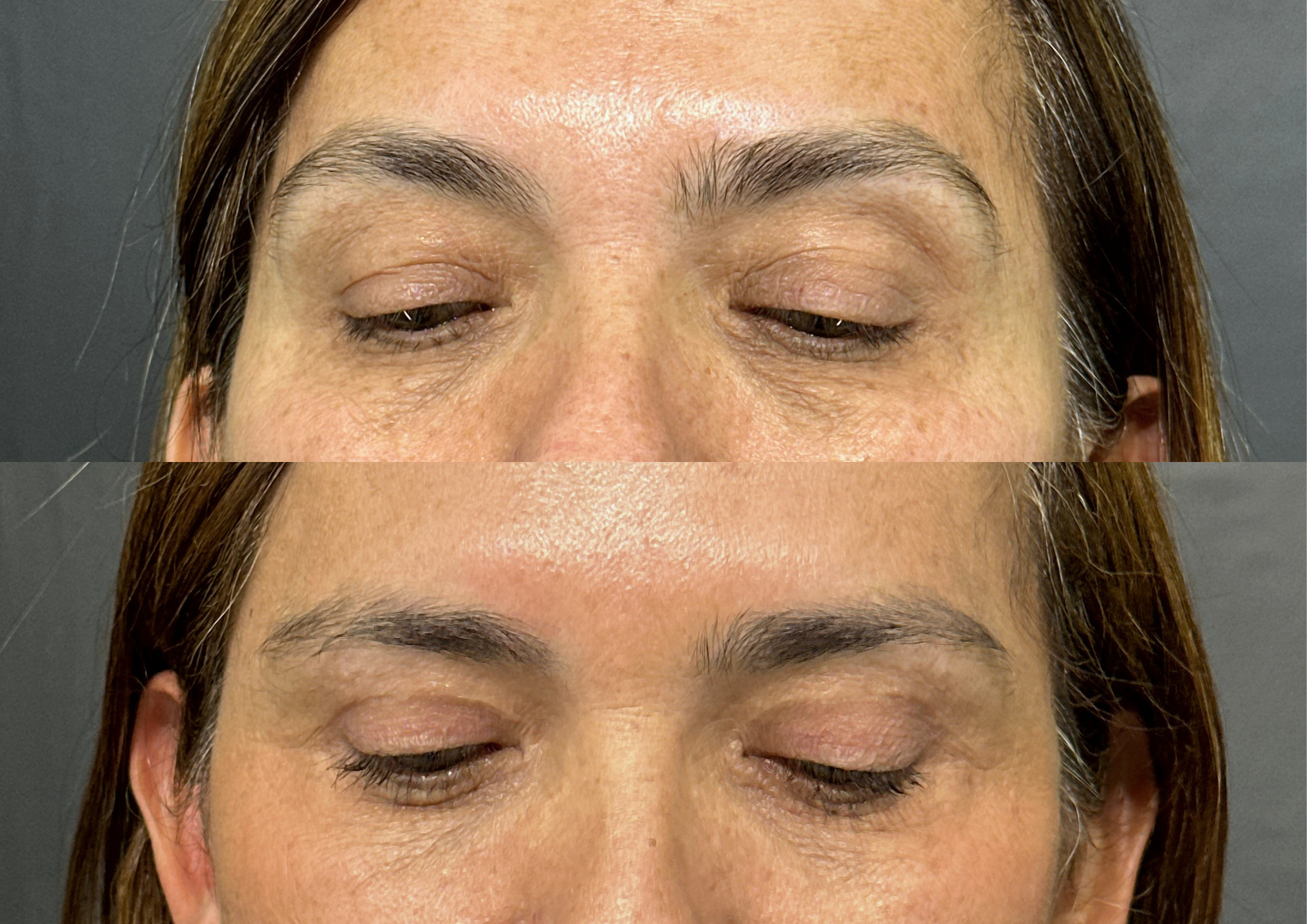 Antes e depois — Foto 2