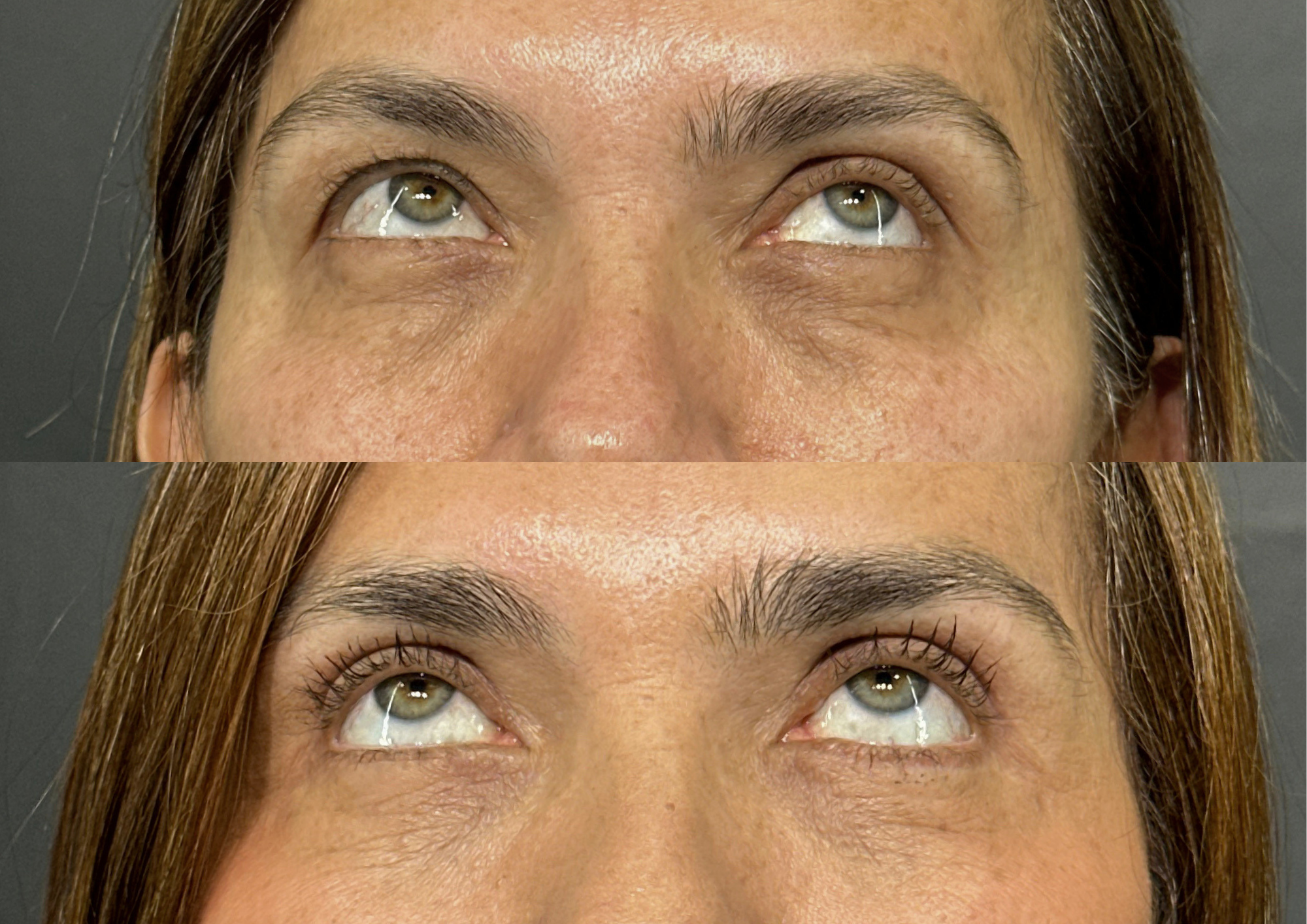 Antes e depois — Foto 3