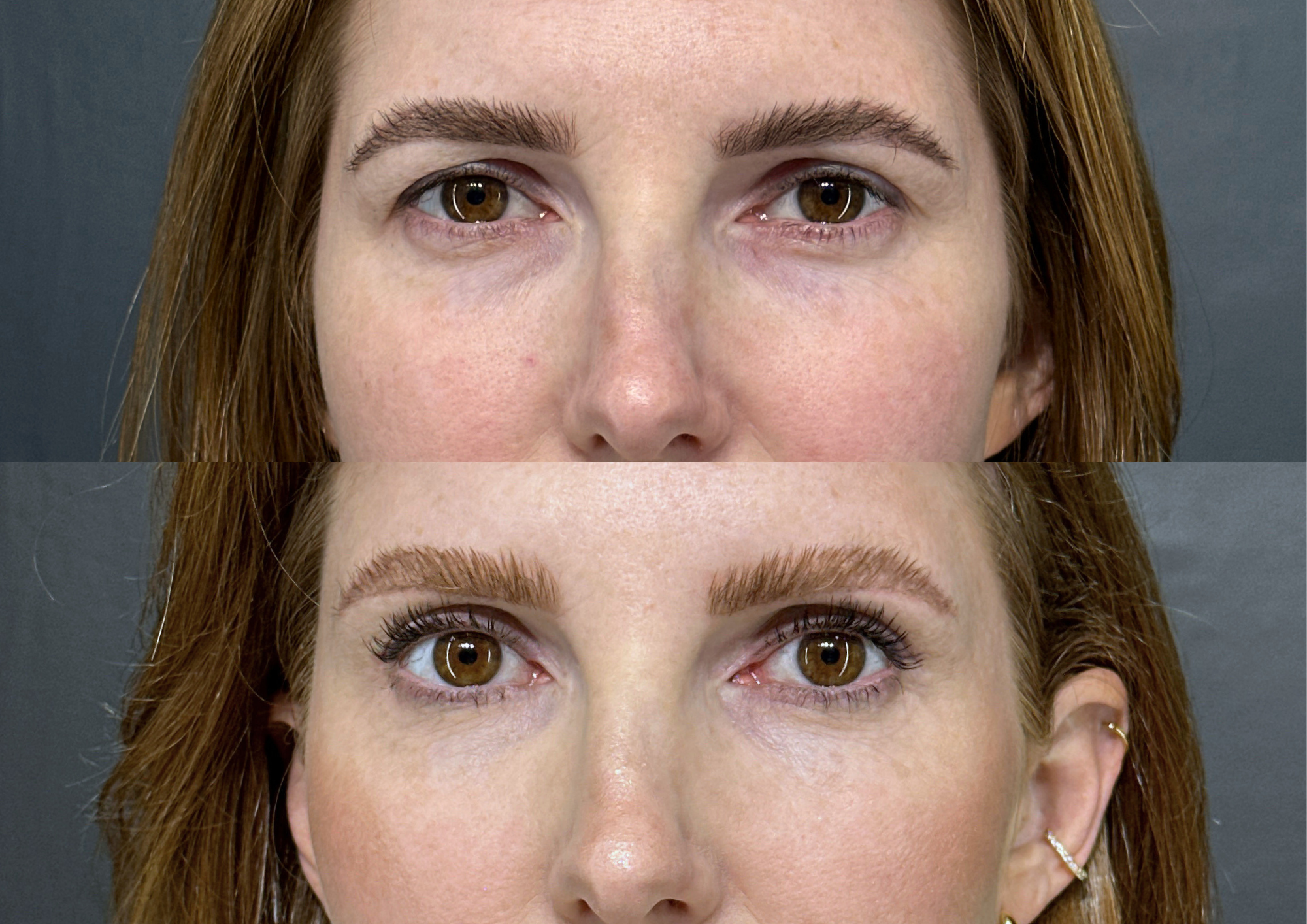 Antes e depois — Foto 1
