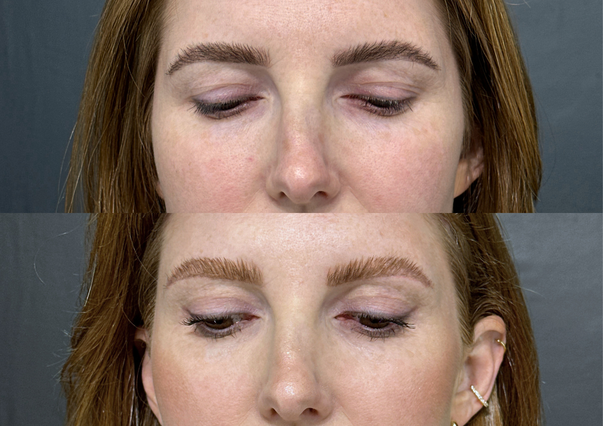 Antes e depois — Foto 2