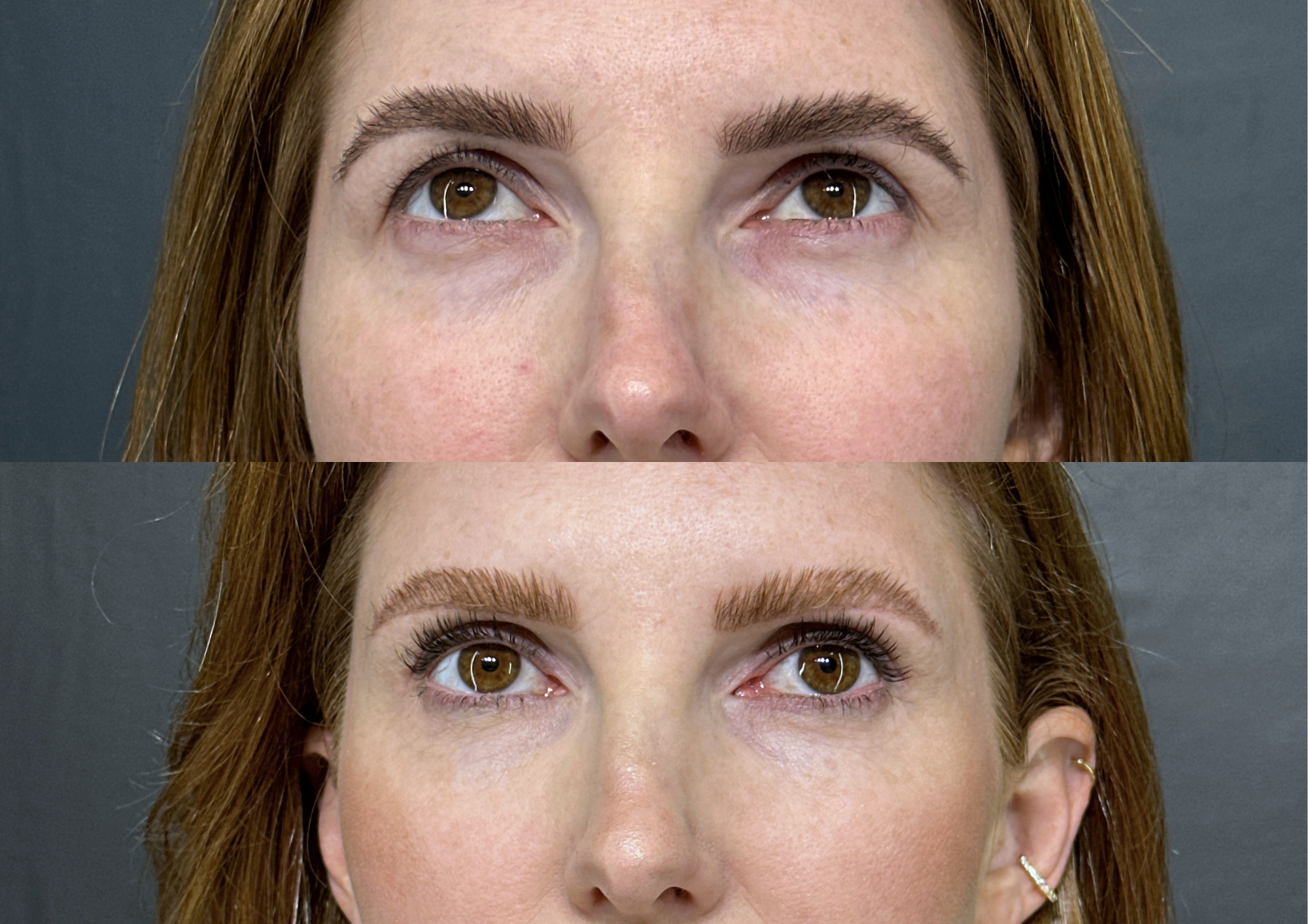 Antes e depois — Foto 3