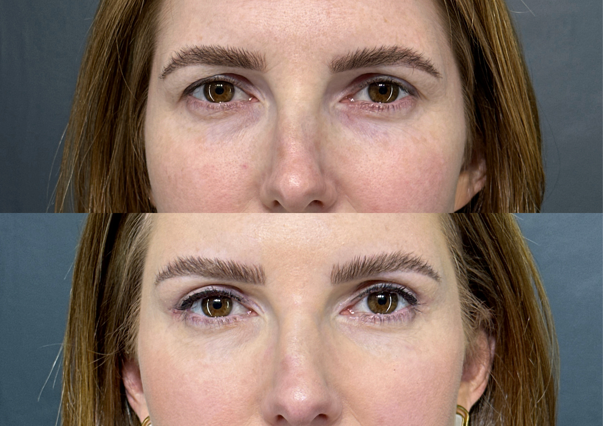 Antes e depois — Foto 1