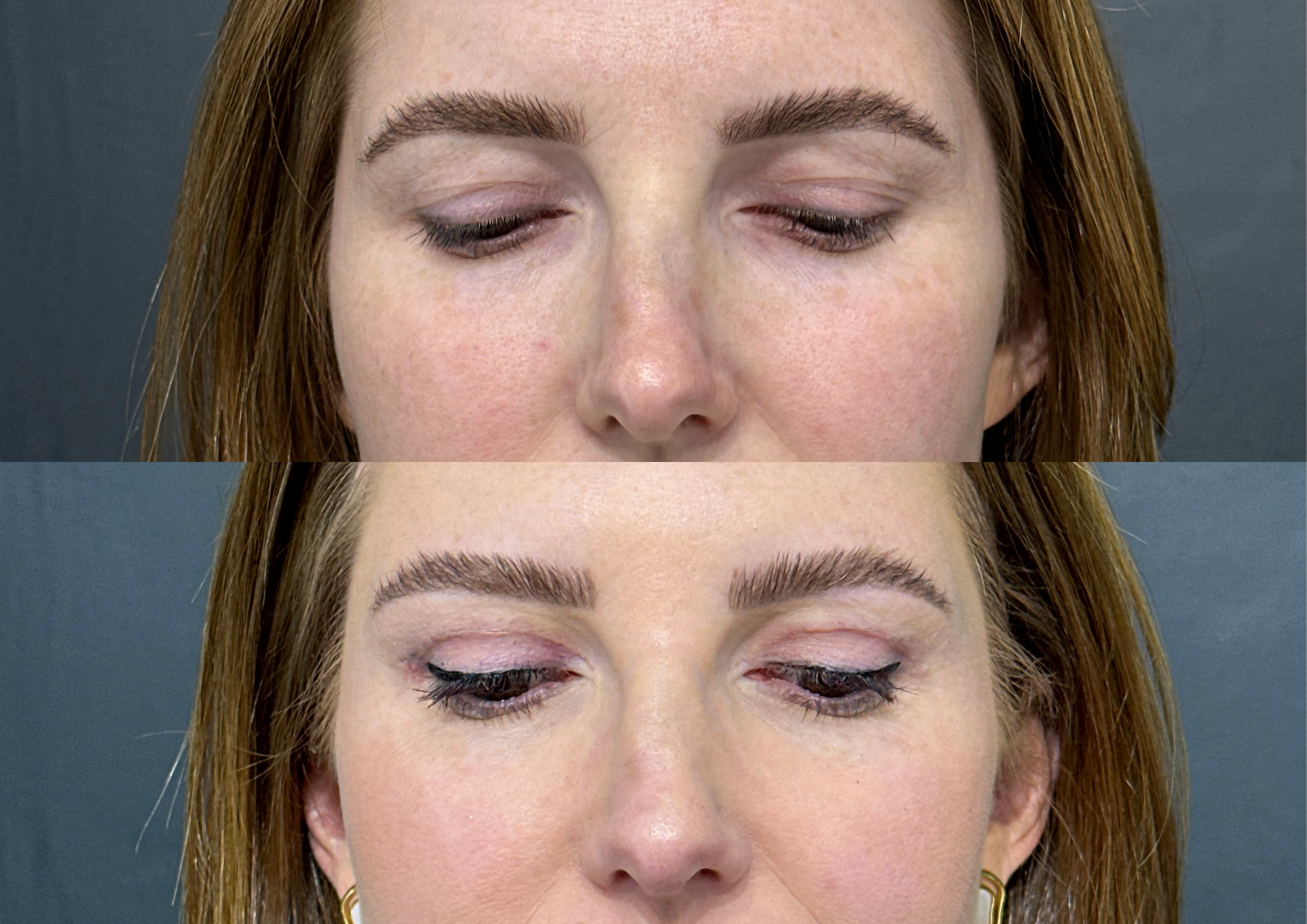 Antes e depois — Foto 2