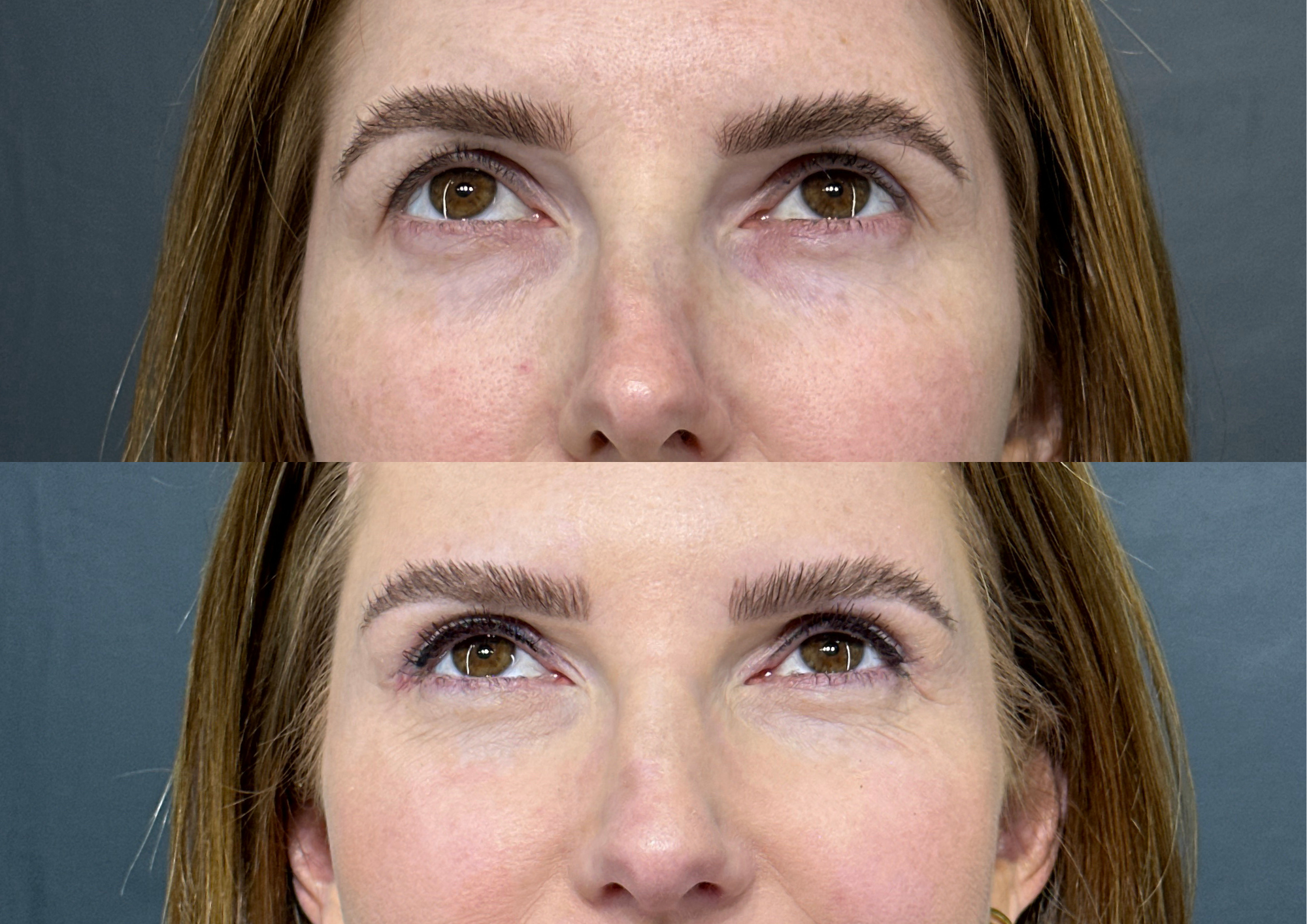 Antes e depois — Foto 3