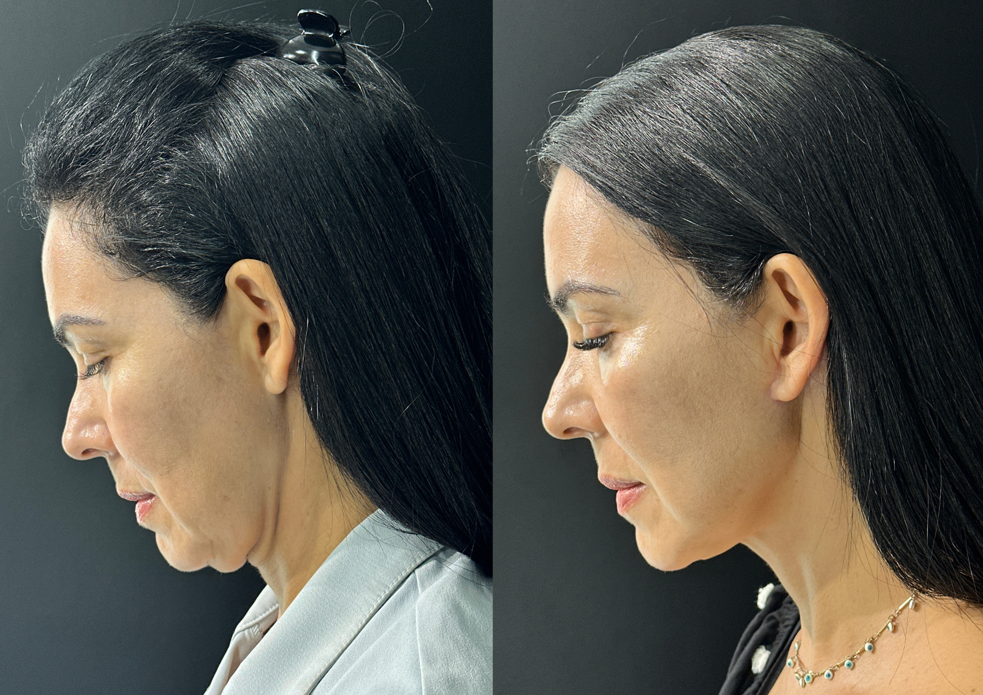 Antes e depois — Foto 1