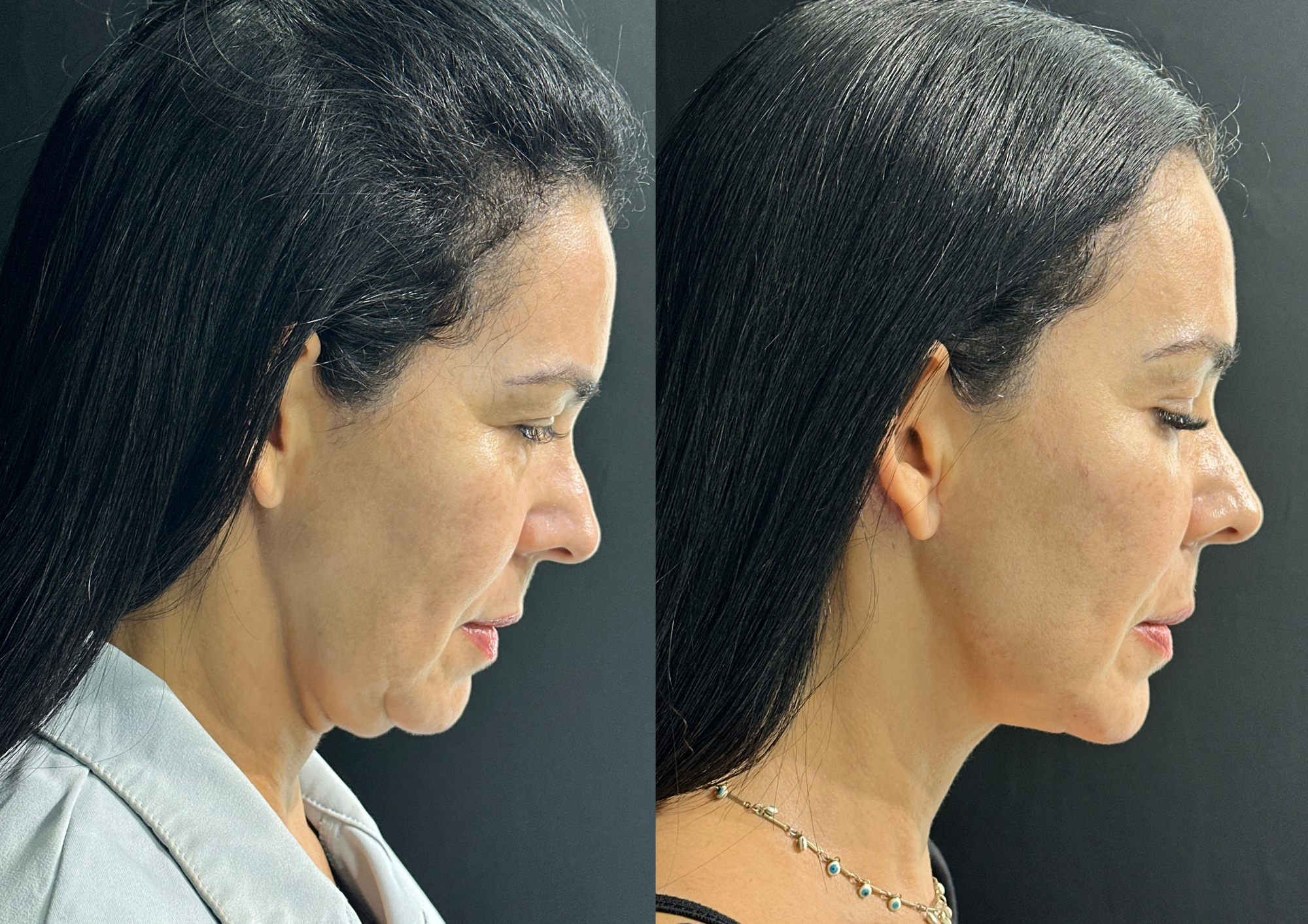 Antes e depois — Foto 2