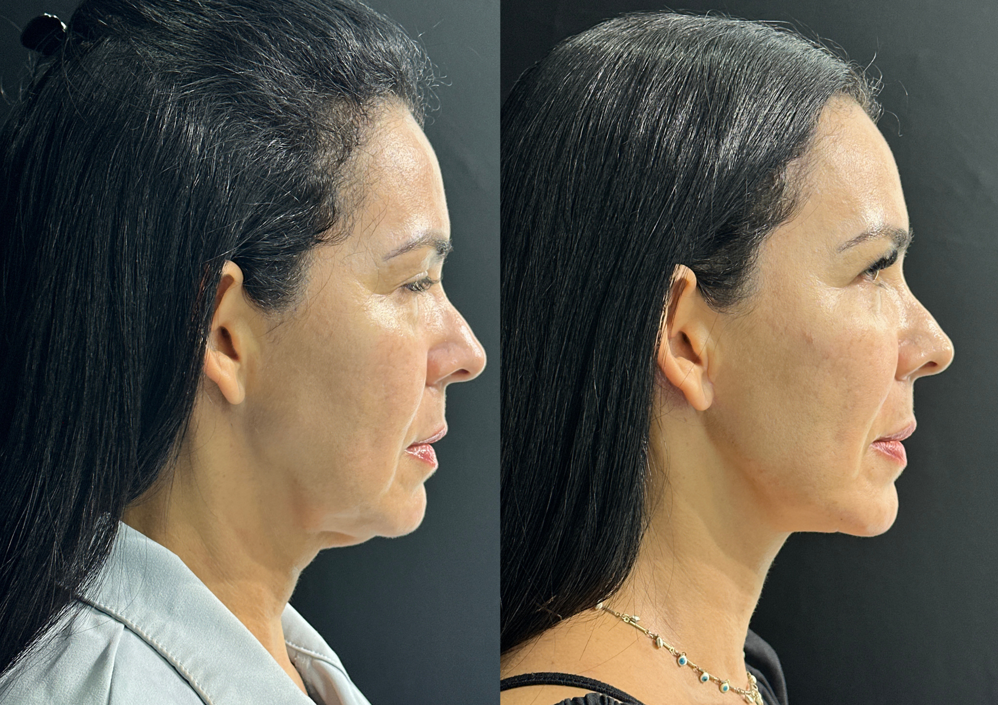 Antes e depois — Foto 3