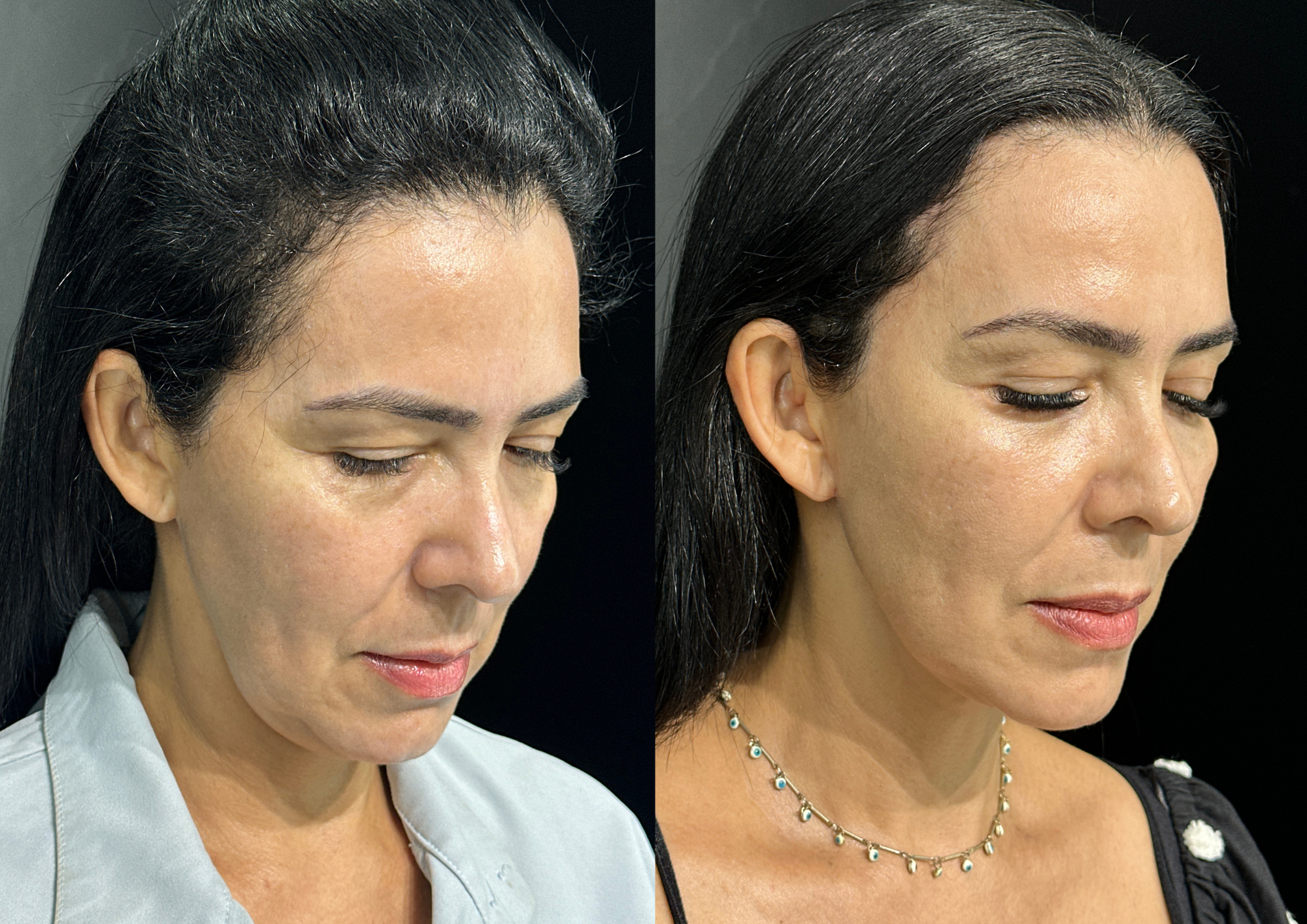 Antes e depois — Foto 4