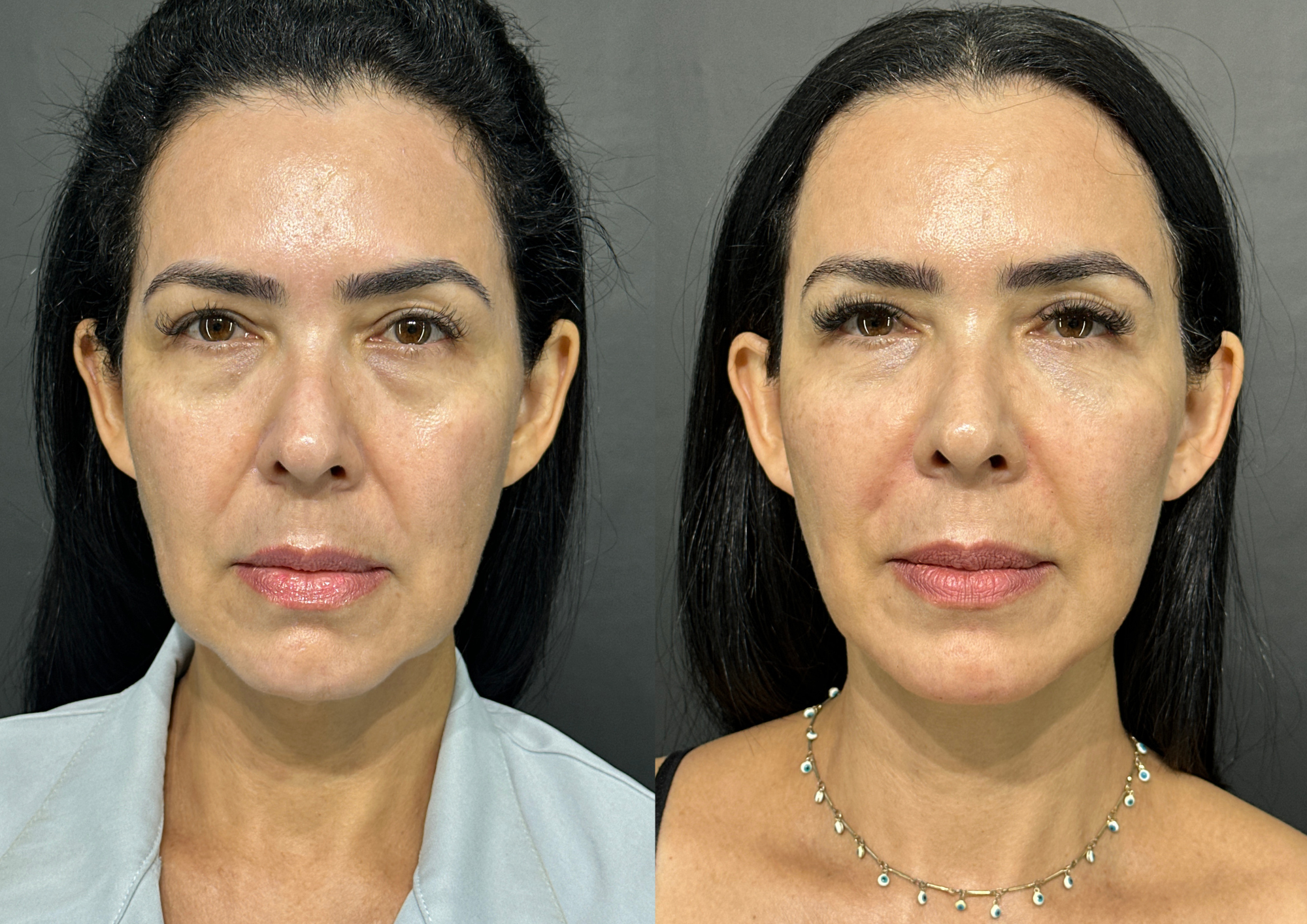 Antes e depois — Foto 5