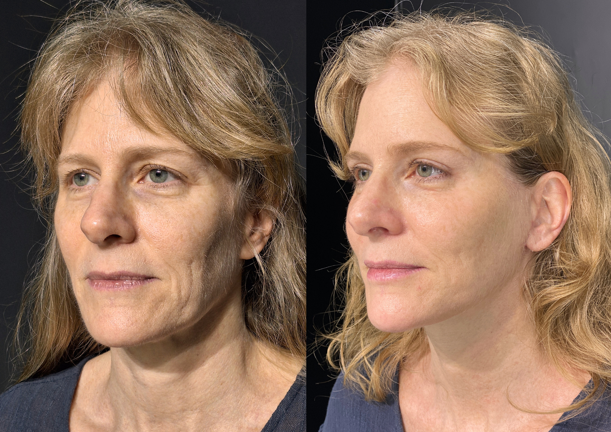 Antes e depois — Foto 1