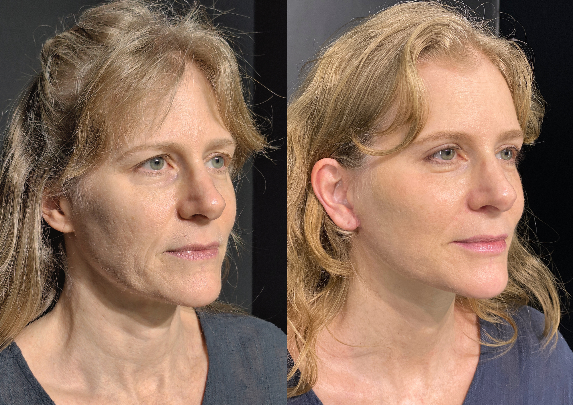 Antes e depois — Foto 2