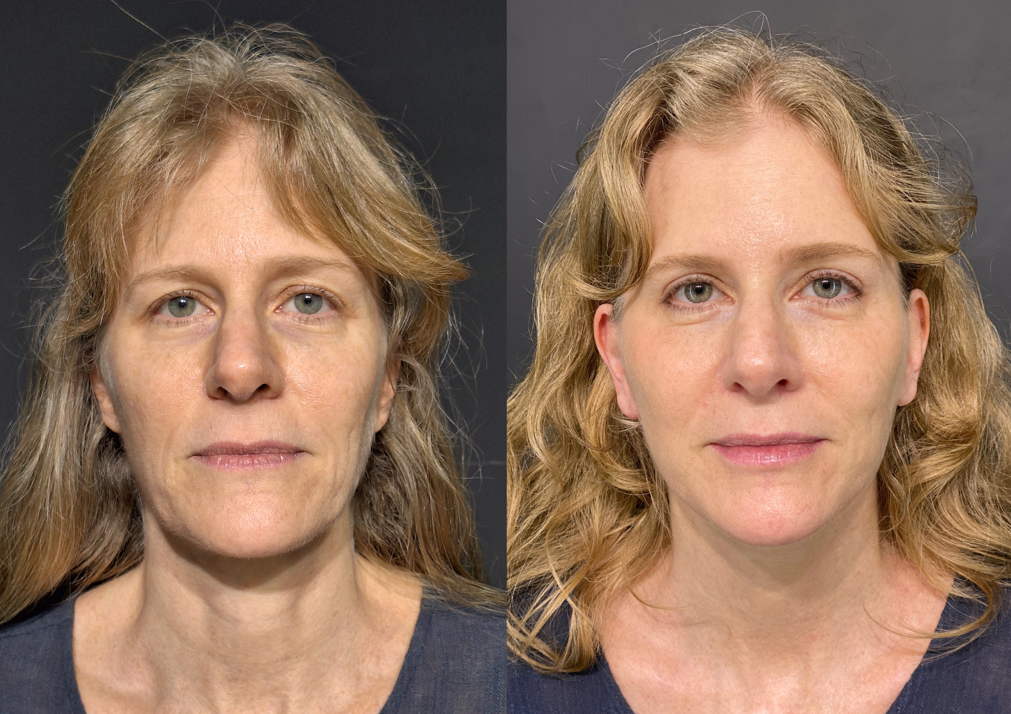 Antes e depois — Foto 3