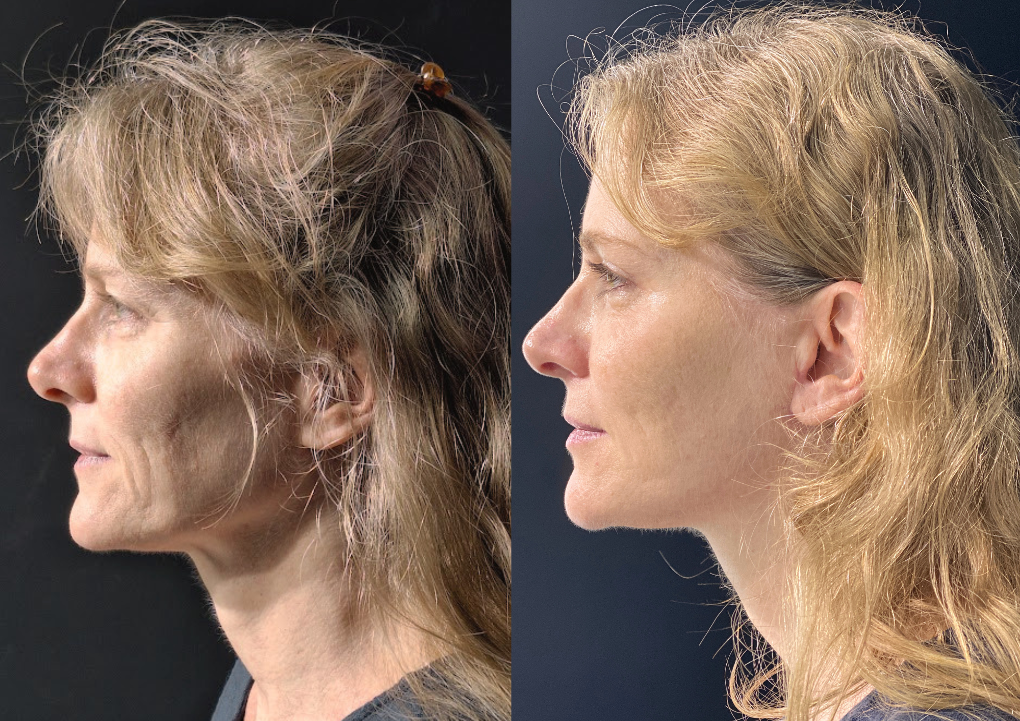 Antes e depois — Foto 4