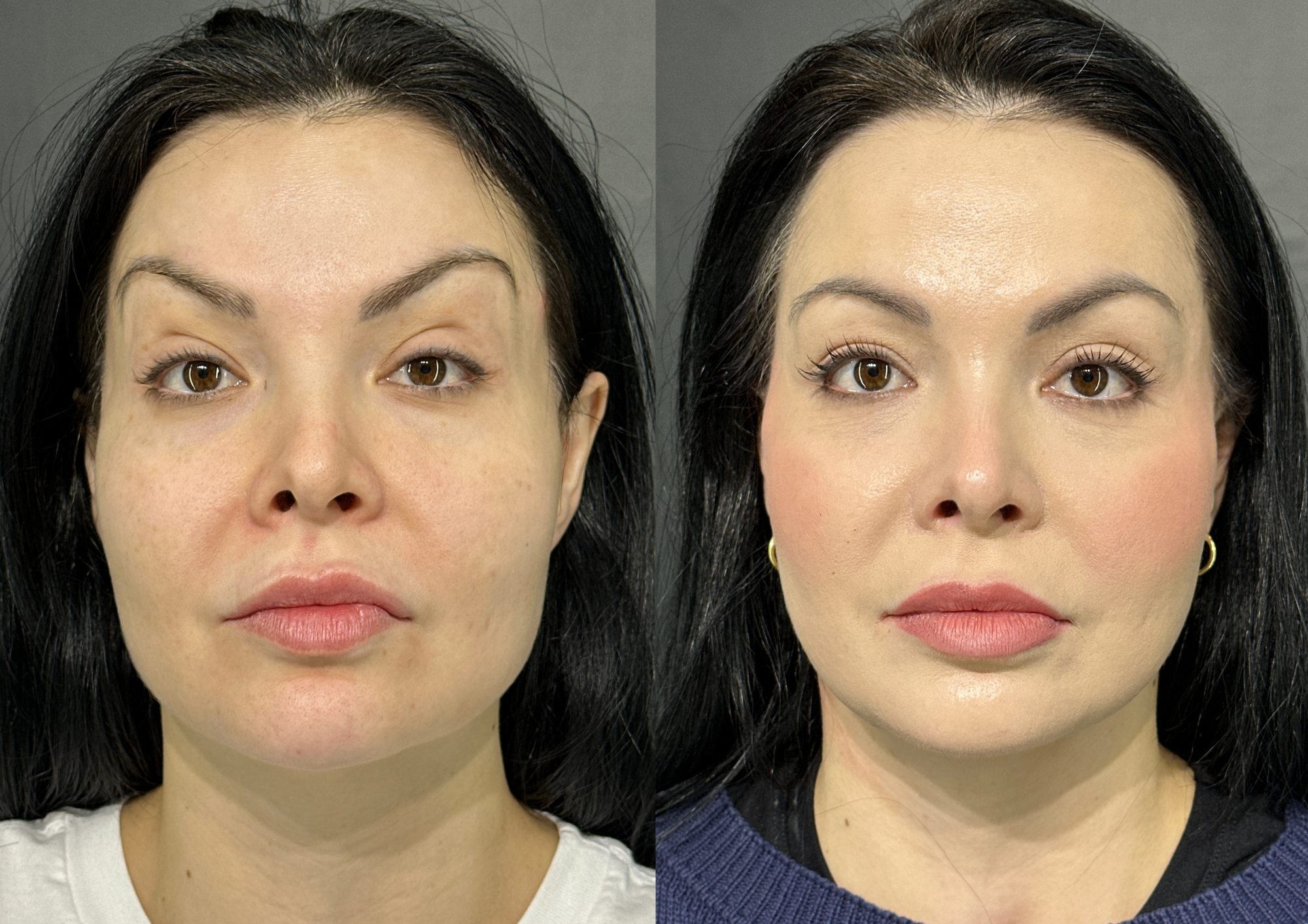 Antes e depois — Foto 1