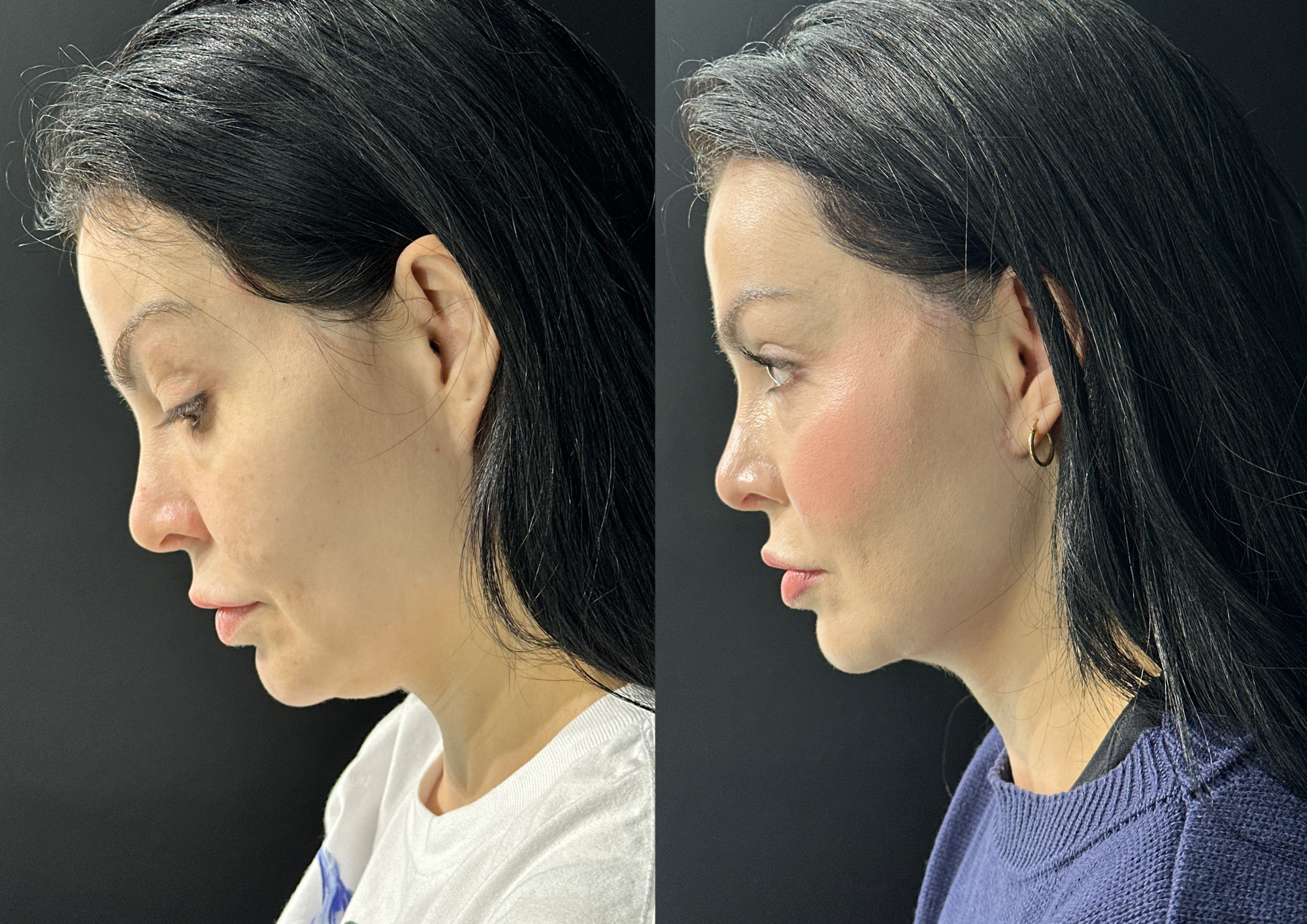 Antes e depois — Foto 2