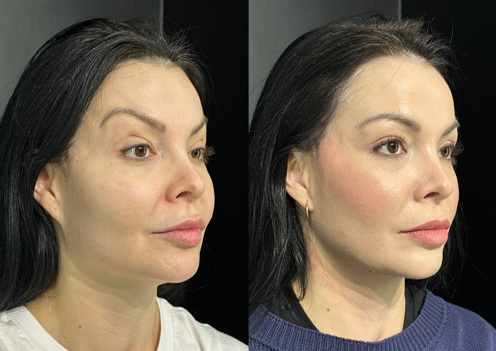 Antes e depois — Foto 3