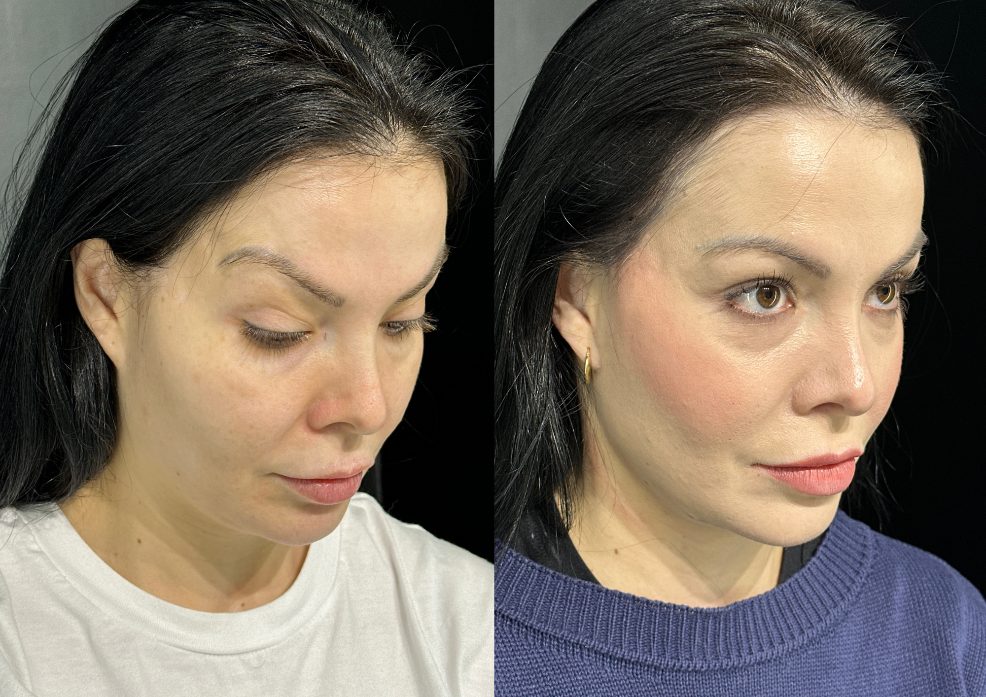 Antes e depois — Foto 4