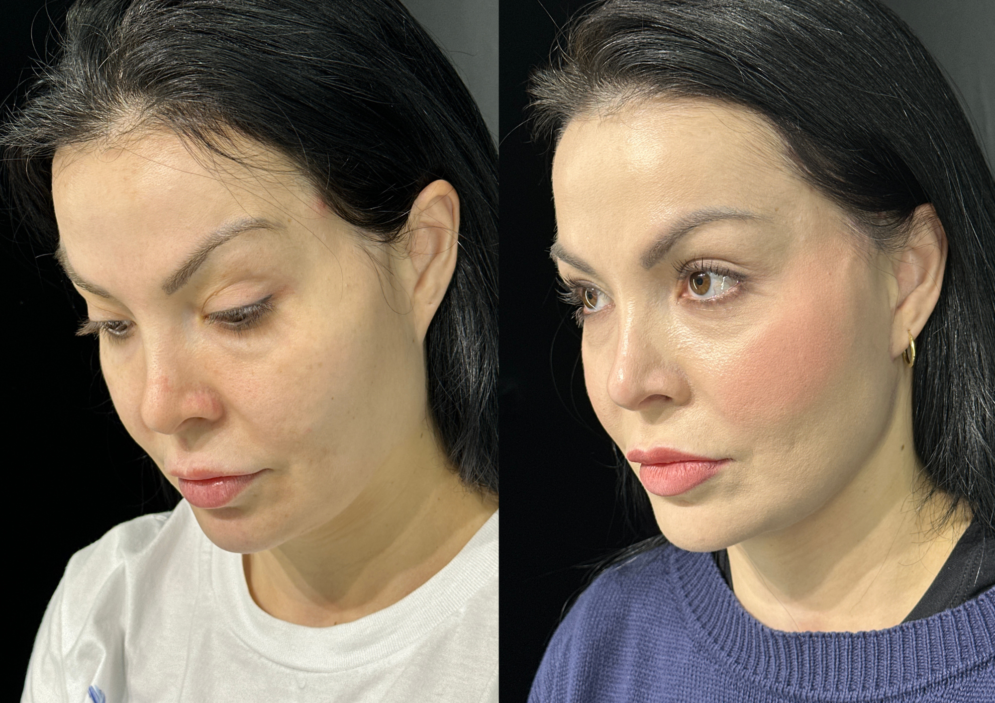 Antes e depois — Foto 5